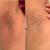 Dark Spot Minimizer Kit - Pina Colada