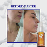 Pro-Heal Serum Advance+